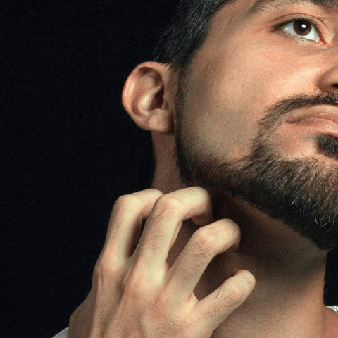 BEARD DANDRUFF - SYMPTOMS, TREATMENT, AND PREVENTION TIPS